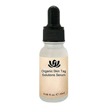 Load image into Gallery viewer, Onkessy Skin Tag Remover Organic Tags Solutions Serum For Fast Removal Moles and Skin Tags Facial Serum for All 20ml
