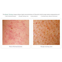 Load image into Gallery viewer, Glytone Exfoliating Body Lotion With 17.5 Free Acid Value Glycolic Acid, Keratosis Pilaris, KP, Smooths Rough &amp; Bumpy Skin, Chicken Skin, Fragrance-Free, 8.4 oz.

