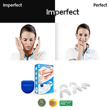 Load image into Gallery viewer, The ConfiDental - Pack of 5 Moldable Mouth Guard for Teeth Grinding Clenching Bruxism, Sport Athletic, Whitening Tray, Including 3 Regular and 2 Heavy Duty Guard (3 (lll) Regular 2 (II) Heavy Duty)

