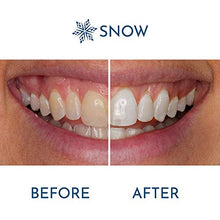 Load image into Gallery viewer, Snow Teeth Whitening Refill - Maximum Strength
