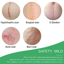 Load image into Gallery viewer, Silicone Scar Sheets,Advanced Scar Removal Sheets,Professional Reusable Scar silicone Scar Strips for C-Section, Surgery, Burn, Keloid, Injuries Acne and Stretch Marks,Old &amp; New Scars,3&quot;1.6&quot;, 4 Sheet
