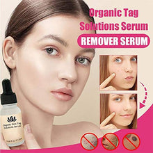 Load image into Gallery viewer, Onkessy Skin Tag Remover Organic Tags Solutions Serum For Fast Removal Moles and Skin Tags Facial Serum for All 20ml
