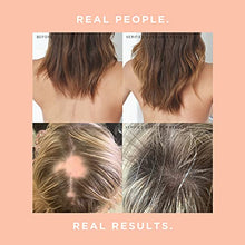 Load image into Gallery viewer, JSHealth Vitamins Hair and Energy Formula | Hair Vitamins for Women and Men | Zinc and Iodine Supplement Hair Growth Vitamin | Hair Loss Supplements | Hair Loss Products for Healthy Hair(60 Capsules)
