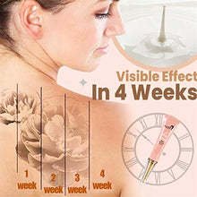 Load image into Gallery viewer, 4 Weeks Tattoo Removal Cream,BINGLI Permanent Removal of Tattoos,Tattoo Removal Cream,Tattoos Remover Gel Fading Away Tool,Safe Moisturize Skin,for Colored and Black Tattoos Removes (3PCS)
