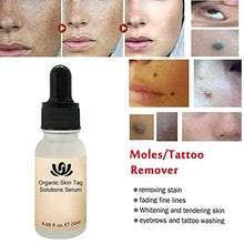 Load image into Gallery viewer, Onkessy Skin Tag Remover Organic Tags Solutions Serum For Fast Removal Moles and Skin Tags Facial Serum for All 20ml
