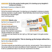Load image into Gallery viewer, Molluscum Contagiosum Treatment with Thuja - terrasil IPL Relief MAX, Pain Free, Formulated for Childrens Sensitive Skin Natural Ointment for Treating Molluscum Bumps, Itch - 50gm
